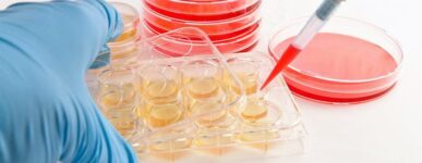 Enhancing Mesothelioma Research with Primary Cell Lines