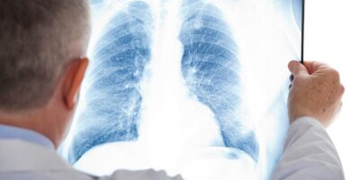 Lung Cancer and Mesothelioma Hide from Early Detection