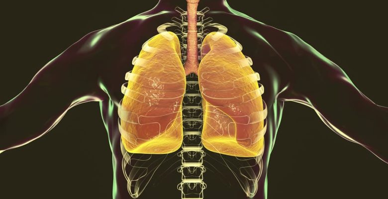 mesothelioma cancer of the pleura