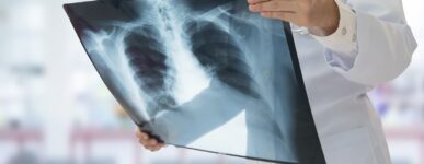 Doctor holding lung xray