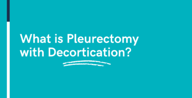 What is Pleurectomy with Decortication?