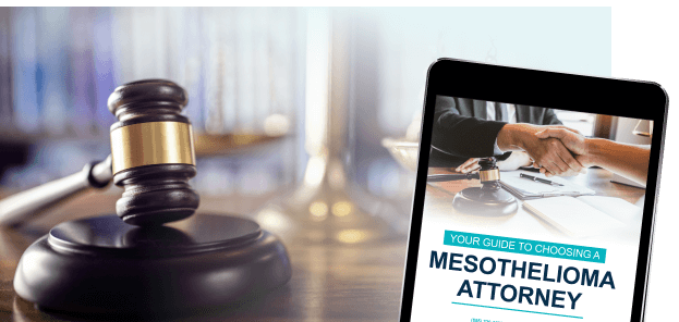 Mesothelioma Attorney Questions Checklist