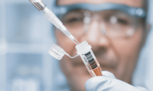 A tissue sample is prepared for biopsy to make a mesothelioma diagnosis