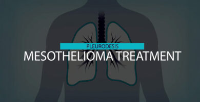 pleurodesis mesothelioma treatment