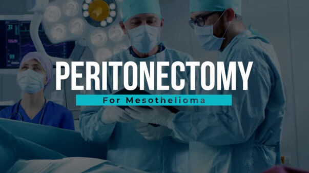 Peritonectomy for Mesothelioma Video Thumbnail