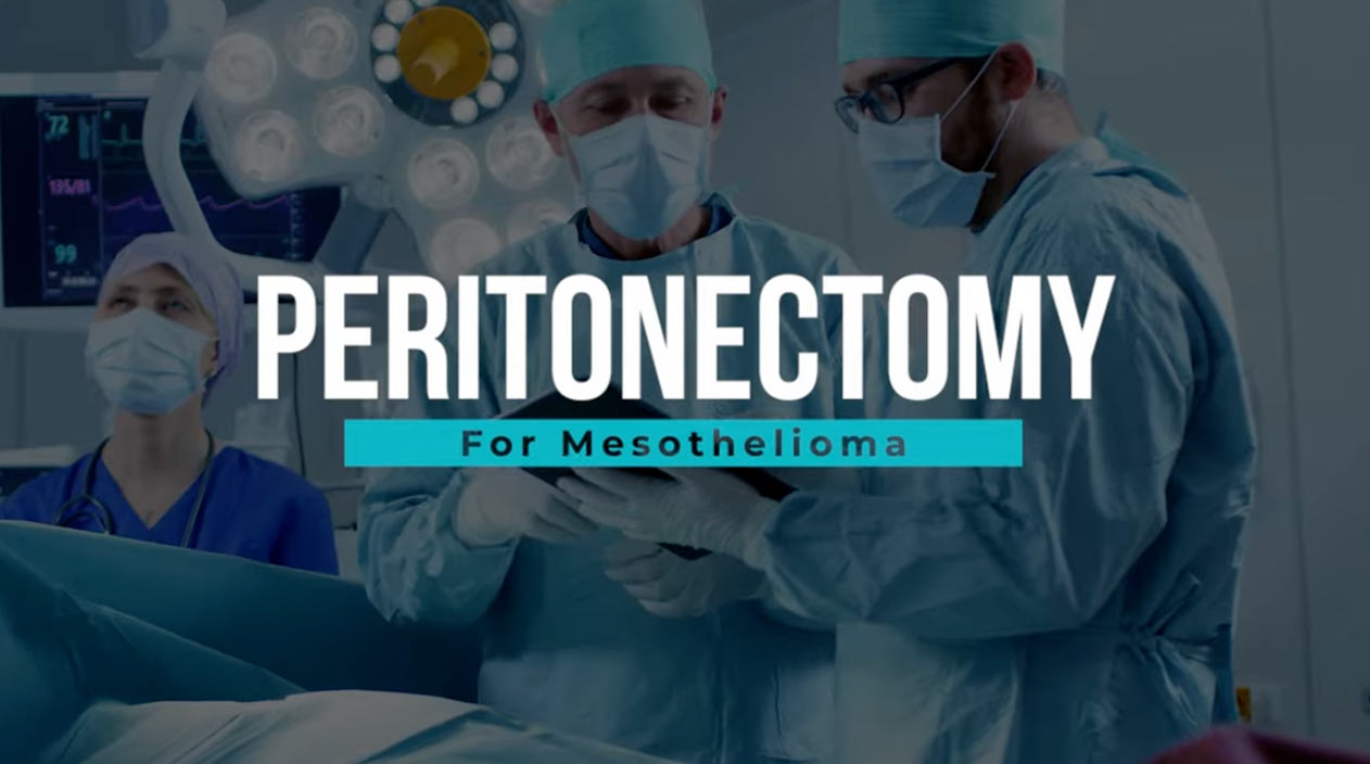 Peritonectomy for Mesothelioma Video Thumbnail