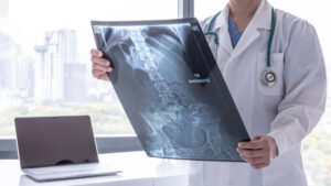 A doctor reviews a patient's imaging scan
