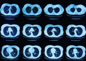 A series of images fom a chest MRI