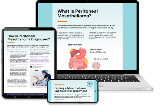 Peritoneal Mesothelioma Patient Guide pulled up on a laptop, tablet, and cell phone