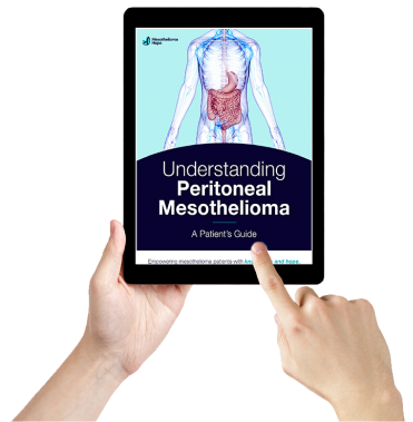 Free Peritoneal Guide