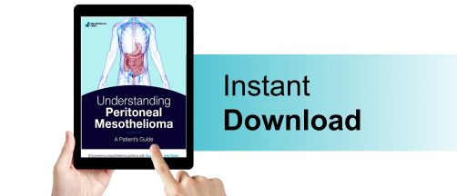 Free Peritoneal Mesothelioma Guide