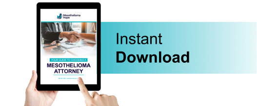 Mesothelioma Attorney Checklist