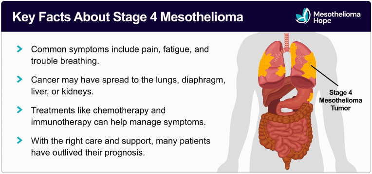 Graphic showing a stage 4 mesothelioma tumor spreading across the body. Text describes key facts about stage 4 pleural mesothelioma.
