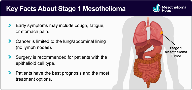 Key Facts About Stage 1 Mesothelioma