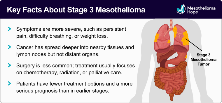 Key Facts About Stage 3 Mesothelioma