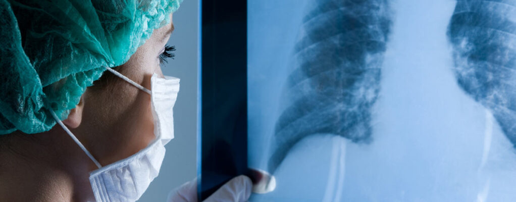 Surgeon reviews a chest X-ray