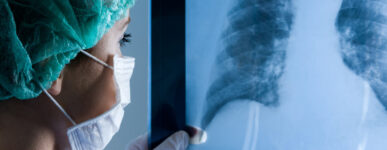 Surgeon reviews a chest X-ray