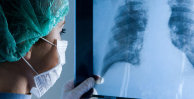 Surgeon reviews a chest X-ray